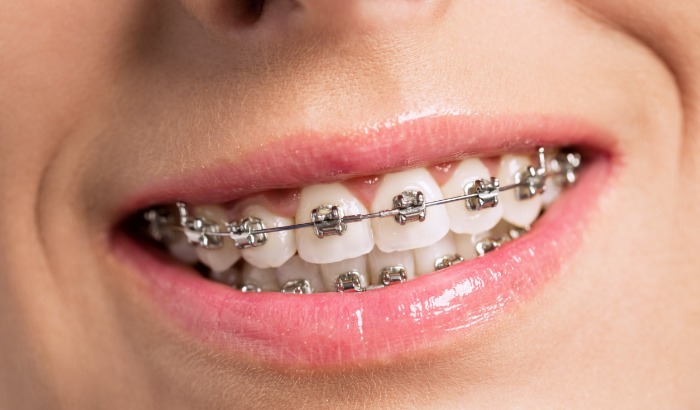 Dr. András Kocsis - Orthodontic Clinic
